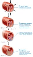 Events of hemostasis: vascular spasm, platelet plug, coagulation