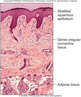 Histological section of skin showing stratified squamous epithelium, dense irregular connective tissue, and adipose tissue