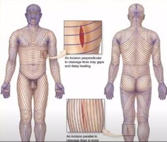 Lines of cleavage on the human body