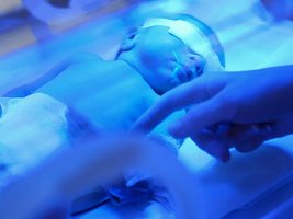 Phototherapy for jaundice and vitamin D deficiency