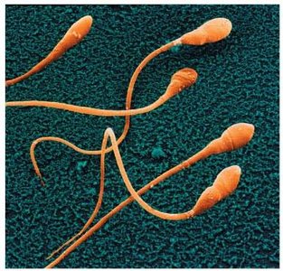 Electron micrograph of sperm cells
