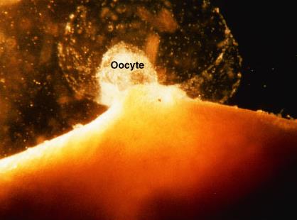 Oocyte released during ovulation