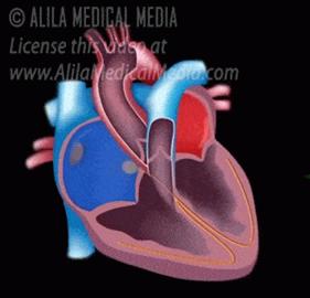 Atrial contraction