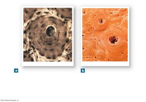 Microscopic view of osteons