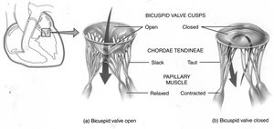 Diagram of heart valves and chambers