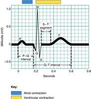 ECG tracing with labeled waves and intervals