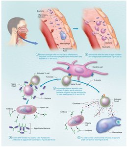 Diagram of the immune response to a bacterial infection