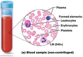 Blood sample showing plasma, erythrocytes, leukocytes, and platelets