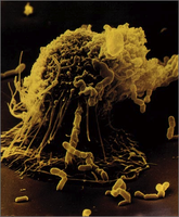 Macrophage engulfing bacteria