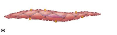 Relaxed smooth muscle fiber with dense bodies and gap junctions