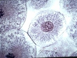 Microscopic image of a cell in prophase