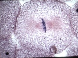 Microscopic image of a cell in metaphase