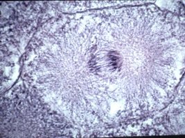 Microscopic image of a cell in anaphase