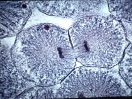 Microscopic image of a cell in telophase