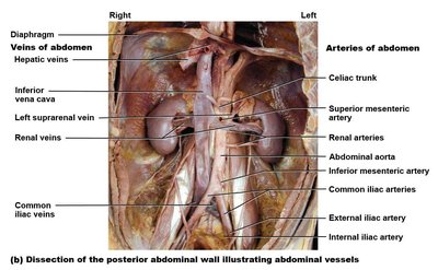 Dissection of abdominal vessels