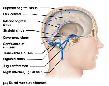 Dural venous sinuses of the brain