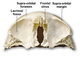 Sectioned frontal bone showing sinuses and foramina