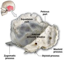 Temporal bone with labeled squamous, petrous, and mastoid parts