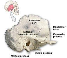 Temporal bone with labeled external acoustic meatus and zygomatic process