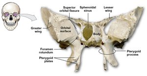 Sphenoid bone with labeled processes and sinuses