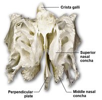 Ethmoid bone with labeled conchae and perpendicular plate