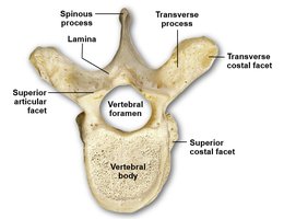 Superior view of thoracic vertebra with labeled features
