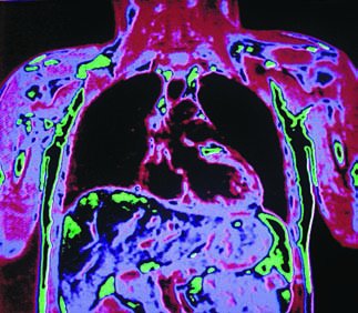 Frontal section MRI scan