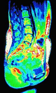 Median (midsagittal) section MRI scan
