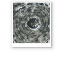 Microscopic view of compact bone showing osteons