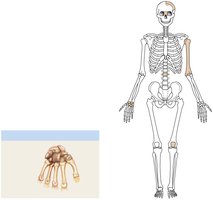Short bone example: carpal bones