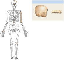Flat bone example: parietal bone