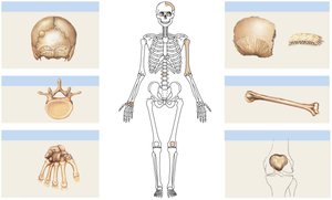 Classification of bone shapes