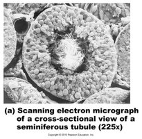 Spermiogenesis: transformation of spermatids into sperm