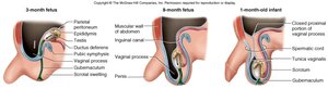 Descent of the testis during development
