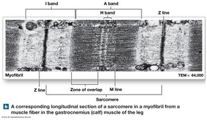 Longitudinal section of a sarcomere