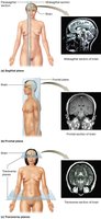 Planes of section: sagittal, frontal, transverse