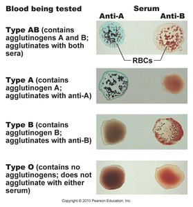 Blood typing reactions with anti-A and anti-B sera