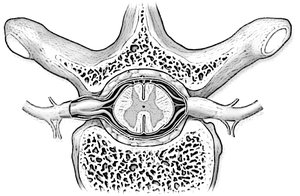 Cross-sectional view of the spinal cord with meninges and bone