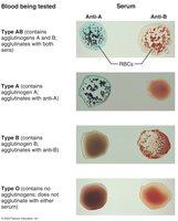 Blood typing reactions with anti-A and anti-B serum