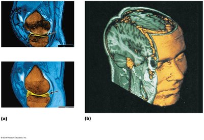 MRI images of knee and head
