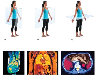 Body planes and corresponding MRI scans