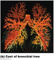 Cast of bronchial tree