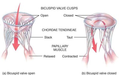 Bicuspid valve mechanism