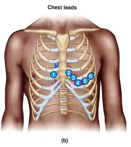 Chest leads for ECG