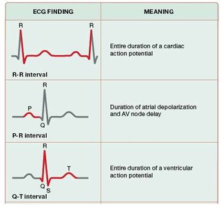 ECG intervals and their meaning
