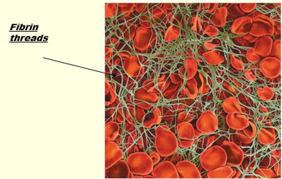 Fibrin threads forming a blood clot