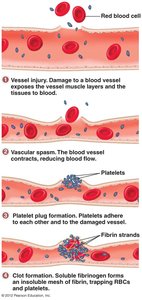 Stages of hemostasis: vascular spasm, platelet plug, and clot formation