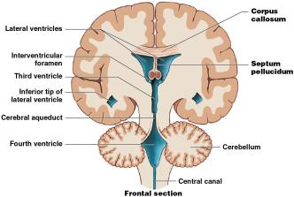 Frontal section of ventricles: Corpus callosum, Septum pellucidum