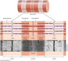 Sarcomere structure with bands and lines
