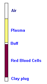 Hematocrit tube showing layers: air, plasma, buffy coat, red blood cells, clay plug